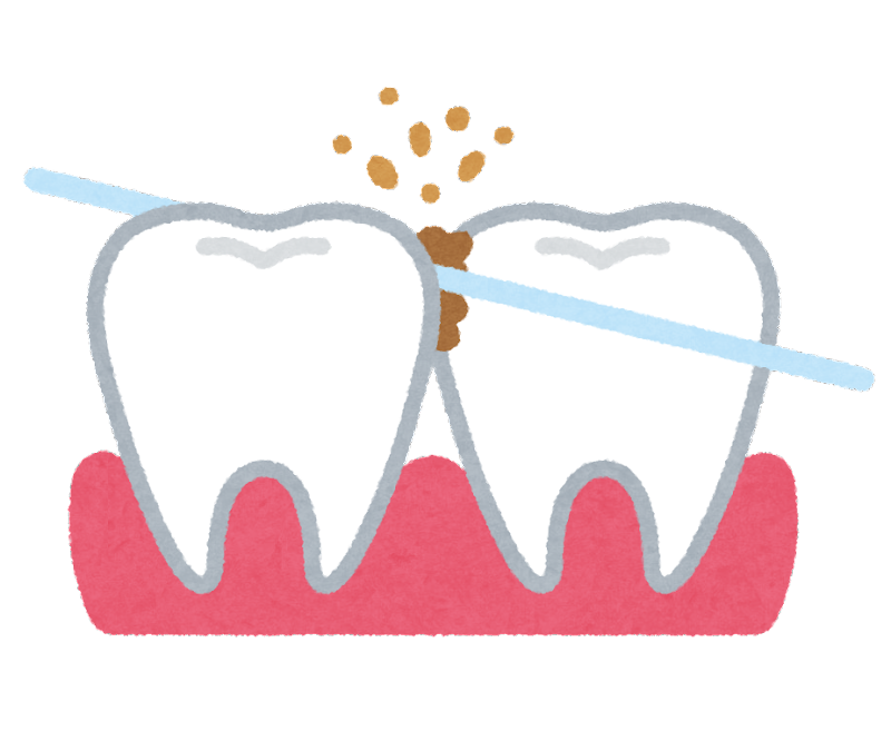 どうして歯ブラシだけじゃダメなの こころ歯科クリニック 飾磨区の歯科 小児歯科 矯正歯科 歯科口腔外科